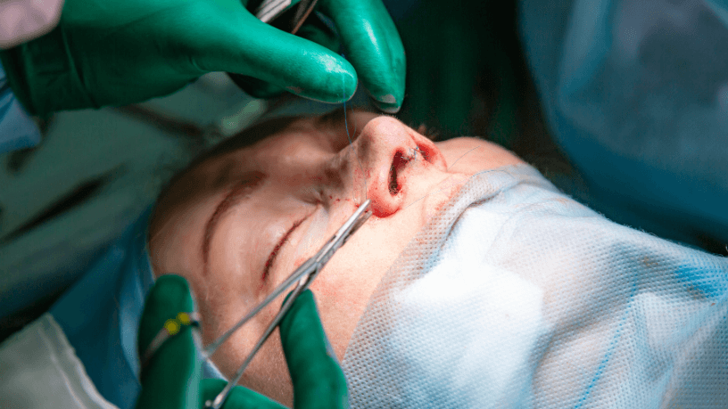 Fique por dentro: A evolução das técnicas que tornaram a rinoplastia mais precisa e previsível